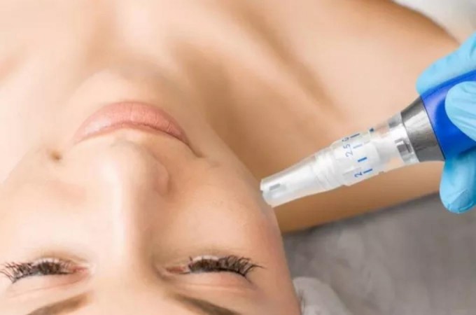skinpen