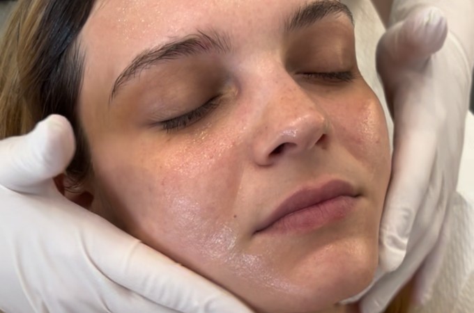 PicoPeel - Results
